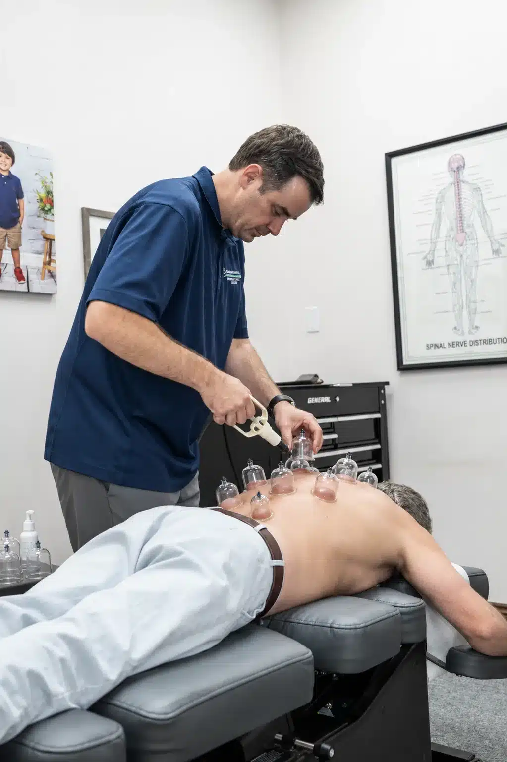 Cupping