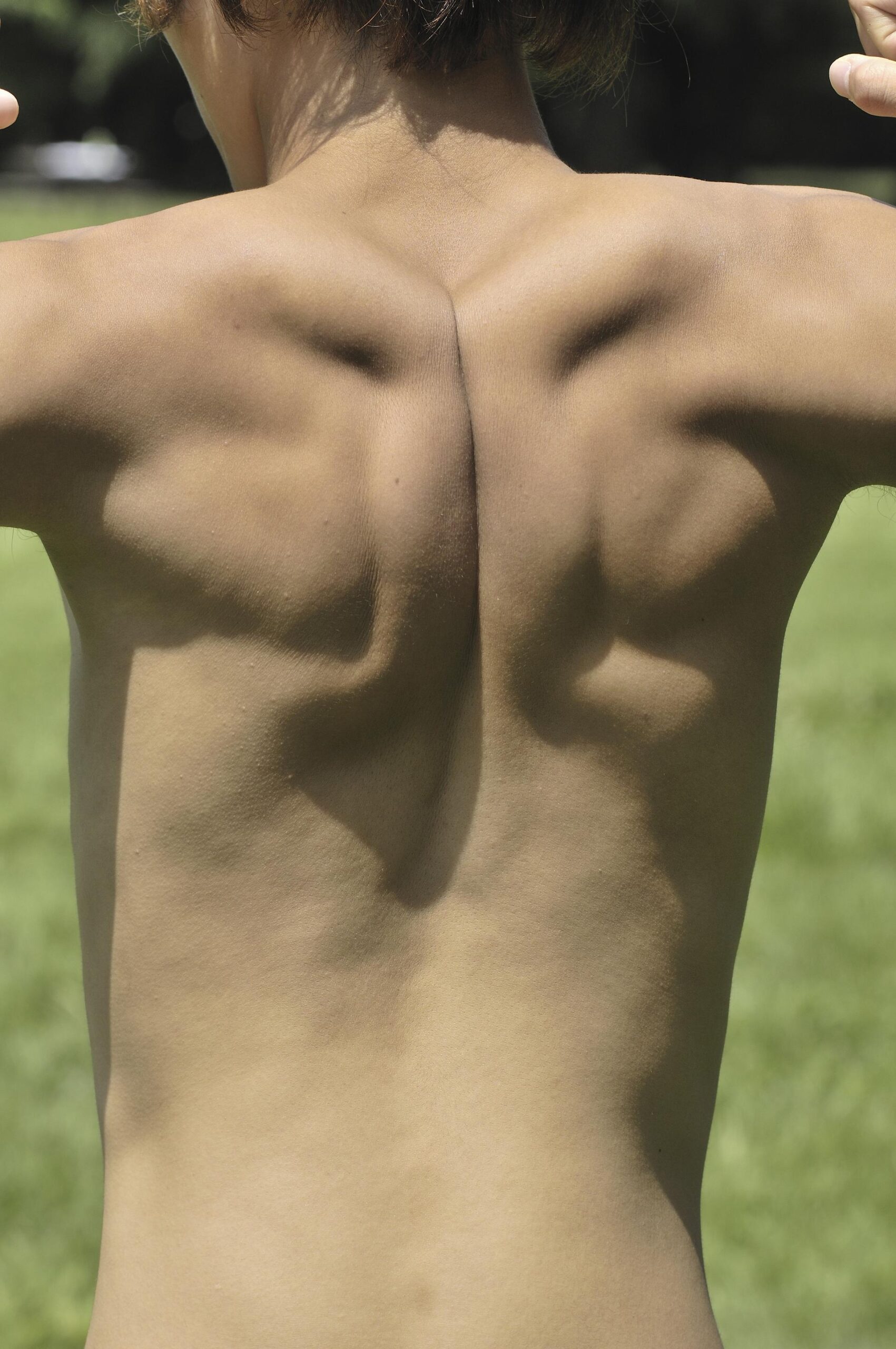 Mid Back Pain