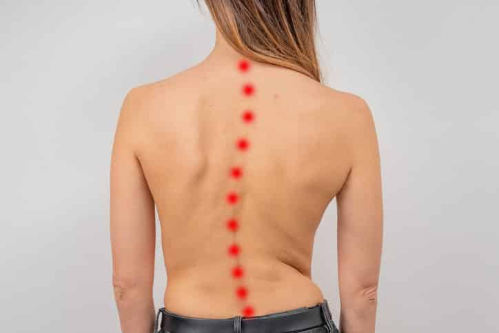 young woman at chiropractor office for scoliosis